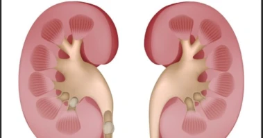 पथरी गलाने का देसी उपाय! इस फल का पानी साफ करेगा किडनी