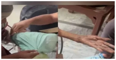 3 ஆண்டுகளாக கையில் பிளாஸ்டிக் கவர்களை சுற்றிருந்த பெண்! காரணத்தை கேட்டு ஆடிப்போன மருத்துவர்கள்! இறுதியில் அந்த பெண்ணுக்கு காத்திருந்த பேரதிர்ச்சி...... வினோத வீடியோ!!!