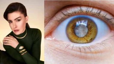 Anne Hathaway Says She Was 'Legally Blind' in One Eye With Early-Onset Cataract for 10 Years