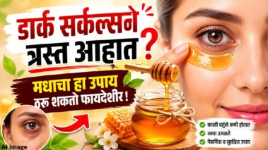 डार्क सर्कल्सने त्रस्त आहात? मधाचा हा उपाय ठरू शकतो फायदेशीर