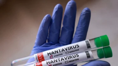 Hantavirus RNA can stay in semen for years, may offer lifelong immunity: What study reveals