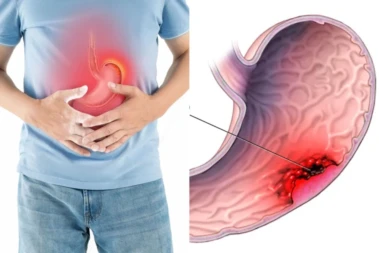 Stomach Cancer: Doctor Warns THIS One Untested Infection Could Be The Biggest Health Threat You're Missing