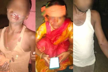 Ranchi News : नाली विवाद को लेकर दो पक्षों में झड़प, महिला समेत 3 घायल