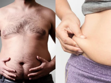 Not All Belly Bulges Are Fat: Know Hidden Causes of a Protruding Stomach Revealed