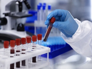 K'taka on high alert after WHO declares Ebola outbreak global health emergency