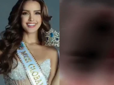 Viral Video: Miss Venezuela 2025 Andrea del Val Reveals Injuries After Assault By Stylist