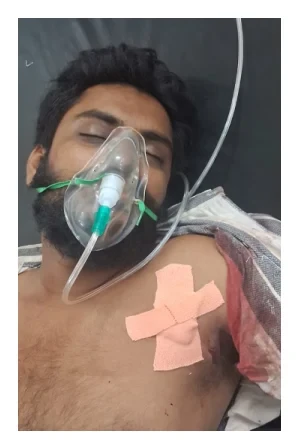 चाकू से जानलेवा हमला, युवक गंभीर रुप से घायल
