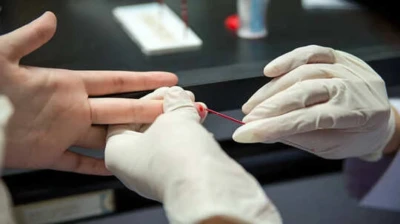 Fever, Viral, Or Malaria: Which Tests To Take For Malaria Diagnosis?