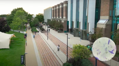 Meningitis Outbreak: University of Kent Student Among Two Who Died of the 'Invasive' Disease