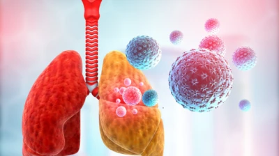 Flu Symptoms in 2026 Show New Pattern, Including Lung Damage Linked to K Variant