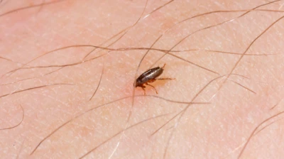 Flea-borne Typhus Surging Across Los Angeles, Officials Urge For Precautions