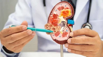 Urological Cancers Rising In India: How Timely Screening Could Save Lives