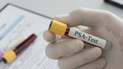 Prostate Cancer Screening In UK To Focus On High-Risk Men; Guidelines Reject Universal Testing