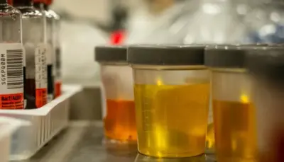 Few Things That Your Urine Tell About You