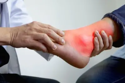 Health Tips: High Uric Acid Causes, Symptoms and How to Control; Check Out