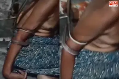 'नागपाश' में जकड़ा पैरालिसिस का मरीज: खिड़की से घुसा विशाल सांप, 2 घंटे तक चला मौत का लाइव खेल