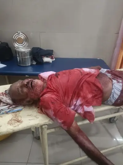 प्रेम मंदिर के समीप घायल अवस्था में मिले अधेड़ की मौत, मध्य प्रदेश निवासी के रूप में हुई पहचान