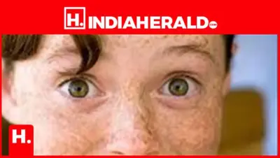 10 Effective Home Remedies to Treat Dark Spots on Face
