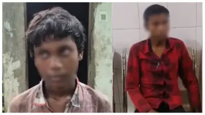 அதிசயம்..! ரேபிஸ் வந்தா பிழைக்கவே முடியாதா?. மரண வாசலில் இருந்து சிறுவன் மீண்டது எப்படி?. 15 வயது சிறுவன் செய்த மிராக்கிள். மருத்துவர்கள் ஷாக்.!!