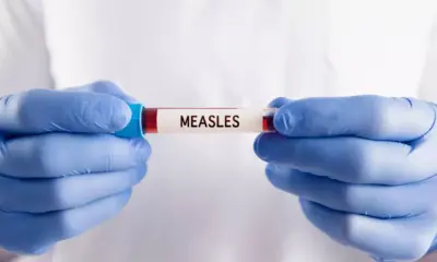 Bangladesh Reports Rising Deaths in Measles Outbreak