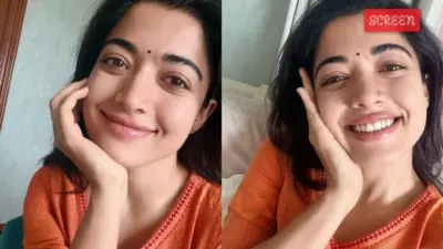 ആരും പേടിക്കേണ്ട... നല്ല വേദനയുണ്ട്, എന്നാല് സഹിക്കാൻ കഴിയാത്തത്ര ഒന്നുമല്ല; രശ്മിക മന്ദാന