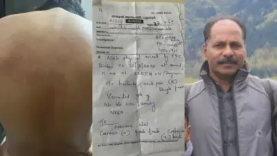 എട്ടാം ക്ലാസുകാരന് നേരെ കായികാധ്യാപകൻ്റെ ക്രൂരത; കേസ് ഒതുക്കിത്തീര്‍ക്കാൻ സ്കൂള്‍ അധികൃതര്‍ ശ്രമിച്ചതായി പരാതി