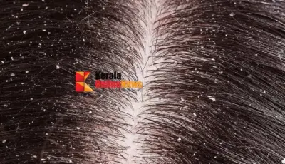 താരനകറ്റി മുടി കൊഴിച്ചില് തടയാൻ ഇതാ ചില പൊടിക്കൈകള്