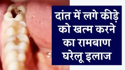 दांतˈ का कीड़ा कैसे निकालें? कैविटी को खत्म करने के लिए रामबाण घरेलू उपाय