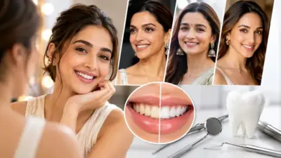 बॉलीवुड जैसी परफेक्ट स्माइल का बढ़ा क्रेज, अब मुस्कान भी बन रही है नया ब्यूटी ट्रेंड