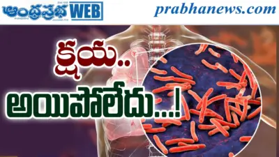 Latent TB | క్షయ. నిశ్శబ్ద బాంబు!