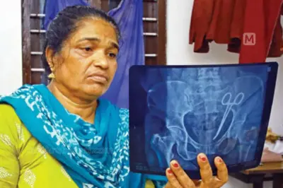 Surgical scissors removed from Usha's abdomen after surgery; handed over to Kerala Police