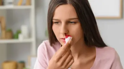 Health Tips: ಬೇಸಗೆಯಲ್ಲಿ ಮೂಗಿನಲ್ಲಿ ರಕ್ತ ಬರುವುದೇಕೆ? ಇದಕ್ಕೇನು ಪರಿಹಾರ?