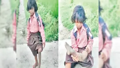 Uttarpradesh | ఒంటికాలితో కుంటుతూ పాఠశాలకు.. యూపీలో ఏడేండ్ల బాలిక దైన్యం
