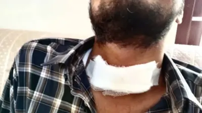 ഡിവൈഡറുകളില് കൊലക്കയര് ശ്രദ്ധിച്ചില്ലെങ്കില് കഴുത്തു പോകും