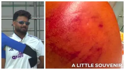 ரசிகர்களை கண்கலங்க வைத்த போட்டோ.! ரிஷப் தோள்பட்டையை தக்காளி போல் பதம் பார்த்த பந்து. இவ்வளவு பெரிய காயத்திலும் 63 ரன் குவிச்சிருக்காரா..? நெகிழ்ச்சி பதிவு.!