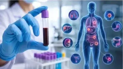 અમદાવાદની Zydus અને Apollo Hospitalsની પહેલ, કેન્સરના વહેલા નિદાન માટે નવી ટેકનોલોજી લોન્ચ