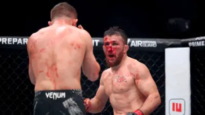 Broken Nose of Merab Dvalishvili Resurface Again as Rumored ...