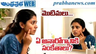 4simptoms |మొటిమలు చర్మ సమస్యేనా? శరీరం చెబుతున్న 'అంతర్గత' హెచ్చరికలు ఇవే!