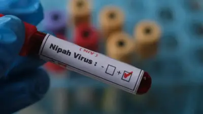 Nipah virus in Keralam: Patient on ventilator; 77 contacts under observation