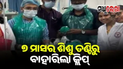 ଅସ୍ତ୍ରୋପଚାର ପରେ ୭ ମାସର ଶିଶୁ ତଣ୍ଟିରୁ ବାହାରିଲା କ୍ଲିପ୍
