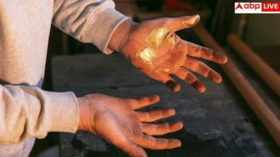 Burned Hand First Aid: खाता बनाते वक्त जल गया है हाथ, तुरंत करें ये काम