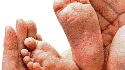 Four doctors in Kerala booked for birth of newborn with genetic disorders