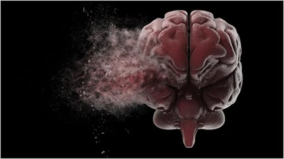 Brain Stroke : బ్రెయిన్ స్ట్రోక్ ప్రమాదం ఎవరికి ఎక్కువ? FAST టెక్నిక్ గుర్తుపెట్టుకుంటే ప్రాణం కాపాడొచ్చు.. లేకుంటే అంతే