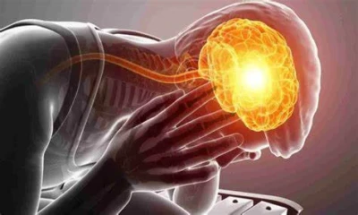 Use of acid reflux drugs linked to higher risk of migraine: Study