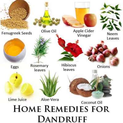 Getting Rid Of Dandruff Naturally Apherald Dailyhunt Lite