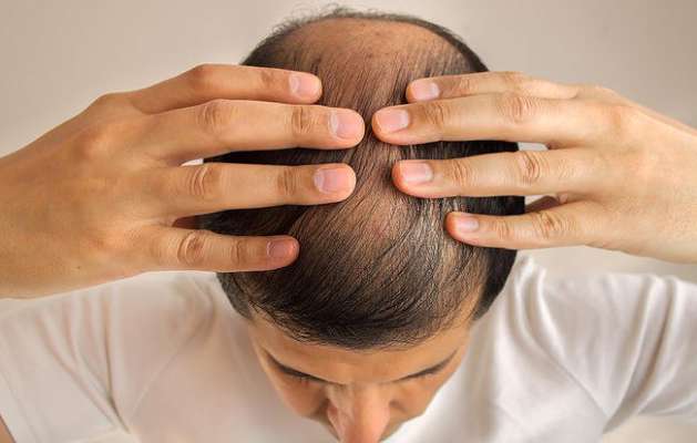 Here Comes A Device To Regrow Hair On Bald Head Odishatv