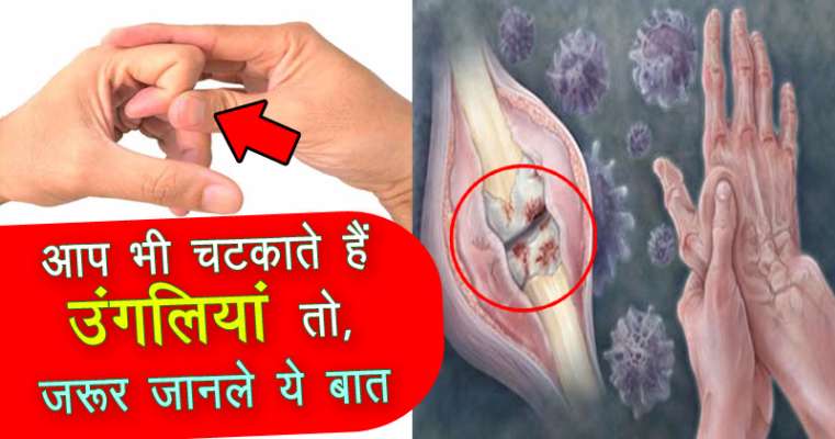 Image result for यदि आपको भी है उंगली चटकाने की आदत तो तुरन्त बदल लीजिये, नही तो