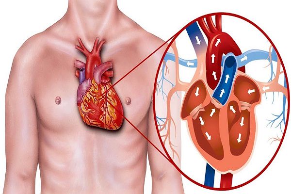 Health tips : शरीर में कोलेस्ट्रॉल बढ़ने पर ये लक्षण दिखाई देते हैं, भूलकर भी न करें नज़रअंदाज