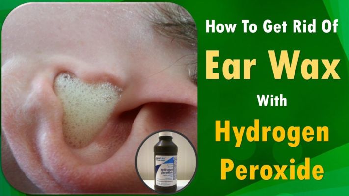 Don T Use Earbuds Use These Ways To Clean Your Ears Safely Tezz Buzz English Dailyhunt