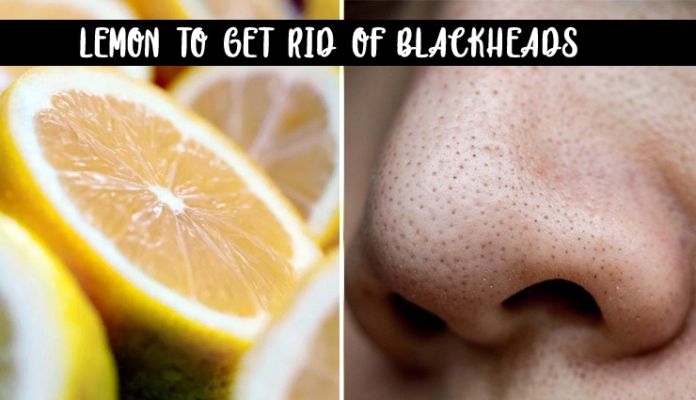 Lemon for blackheads